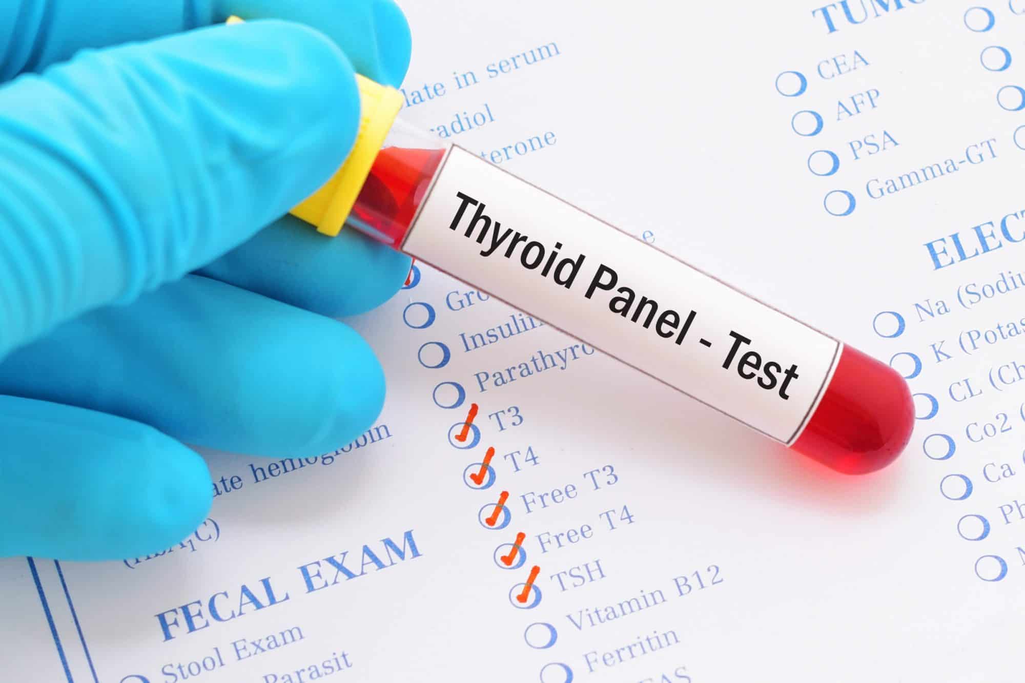 Feline hyperthyroid blood panel